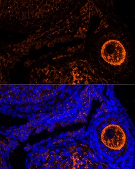 ZP2 Antibody