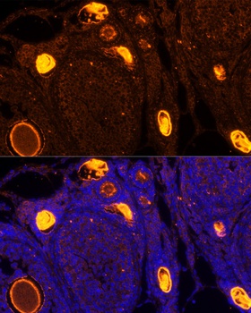 ZP2 Antibody