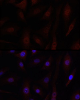 ZP2 Antibody