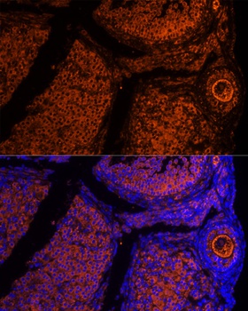 ZP2 Antibody