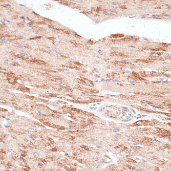 KIR3DL3 Antibody