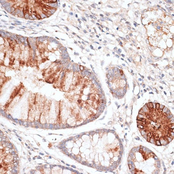 KIR3DL3 Antibody