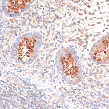 KIR3DL3 Antibody
