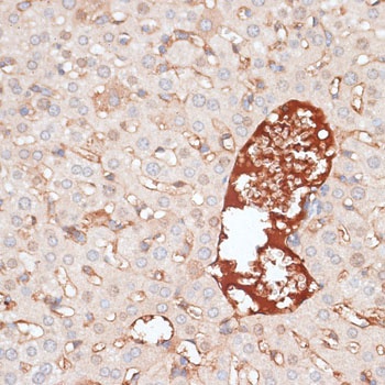 KIR3DL3 Antibody