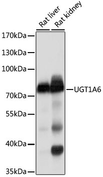 UGT1A6 Antibody