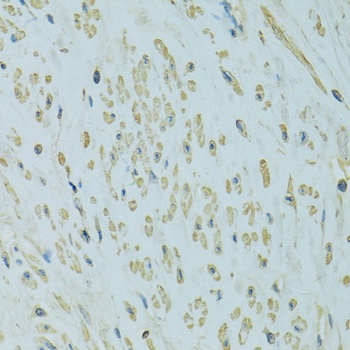 UGT1A6 Antibody