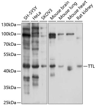 TTL Antibody