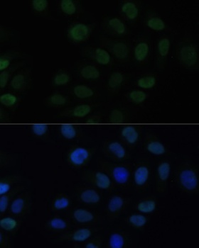 KLF6 Antibody