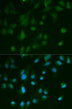 ARRB1 Antibody