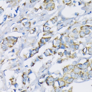 Hexokinase II Antibody