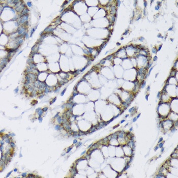 Hexokinase II Antibody