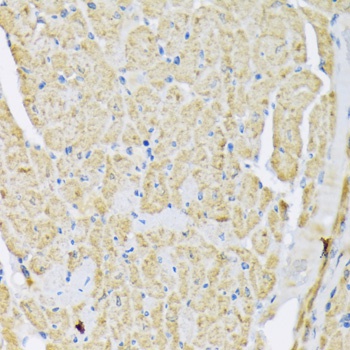 Hexokinase II Antibody