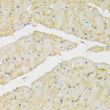 Hexokinase II Antibody
