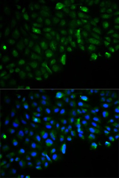 Hexokinase II Antibody