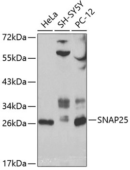 SNAP25 Antibody