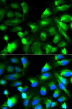 SNAP25 Antibody