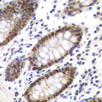 MSH6 Antibody