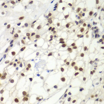 MSH6 Antibody