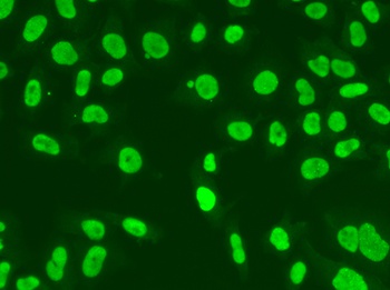 MSH6 Antibody