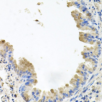 PI3 Kinase p110 beta Antibody