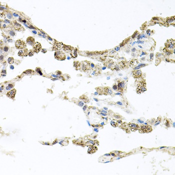 PI3 Kinase p110 beta Antibody