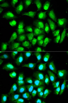 RAN Antibody