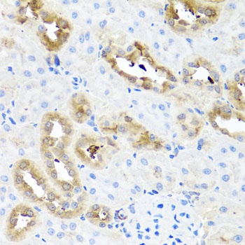 FABP5 Antibody