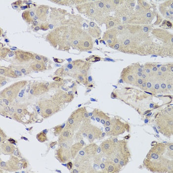 FABP5 Antibody