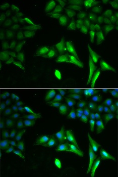 ACADS Antibody