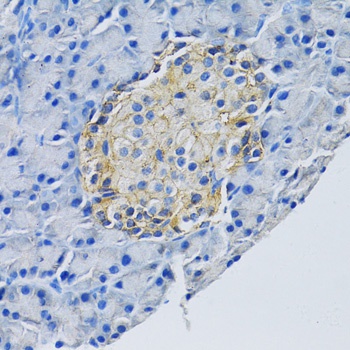 SLC1A2 Antibody