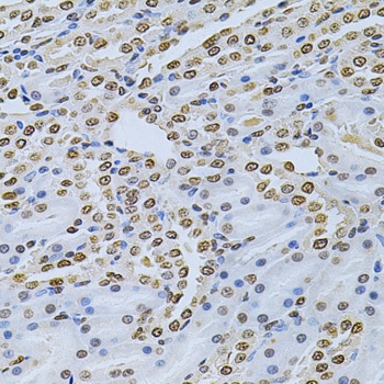 ILK Antibody