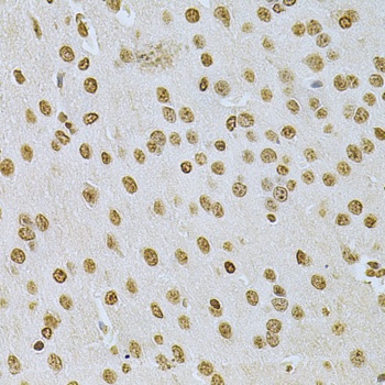 ILK Antibody