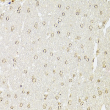 KU70 Antibody