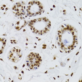 KU70 Antibody