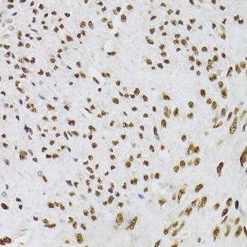 KU70 Antibody