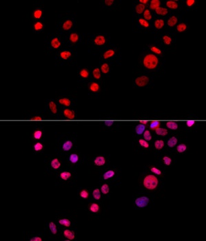 KU70 Antibody