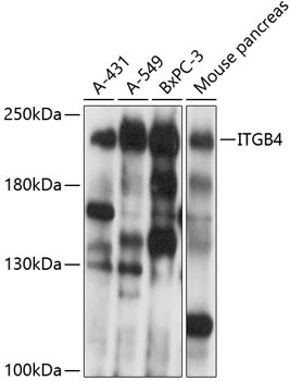 ITGB4 Antibody