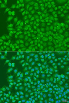BIRC3 Antibody