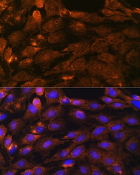 PTCH1 Antibody