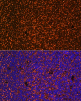 PTCH1 Antibody