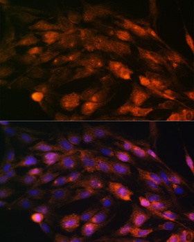 PTCH1 Antibody