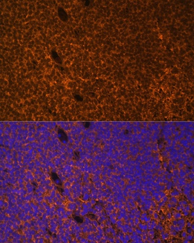 PTCH1 Antibody