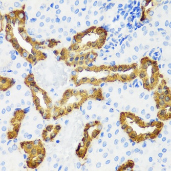 CALB1 Antibody