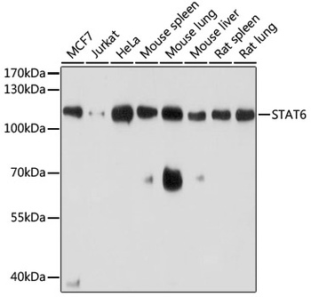 STAT6 Antibody