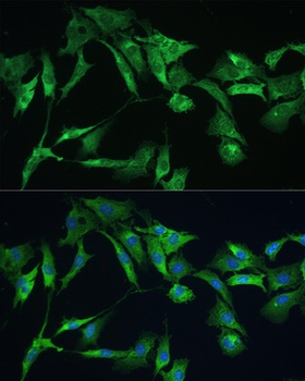 EZR Antibody