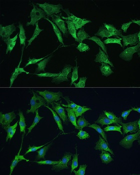 EZR Antibody