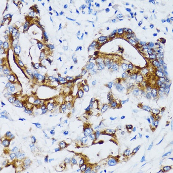 MMP7 Antibody