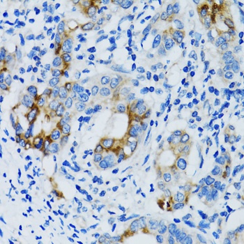 MMP7 Antibody