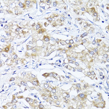 SOCS3 Antibody