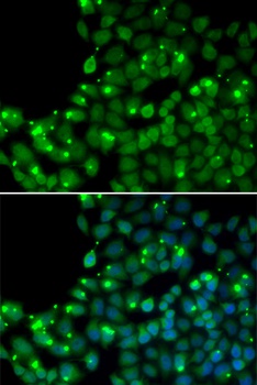MGMT Antibody